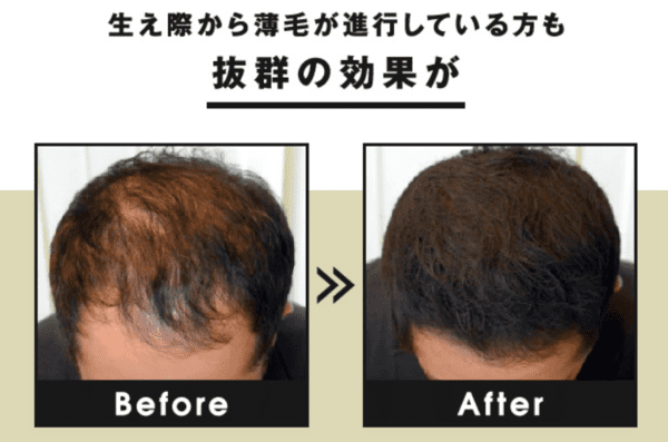 Cax カックス 増毛スプレーの口コミと評判 ７点を検証した驚愕のレビュー 増毛スプレーcaxの口コミブログ