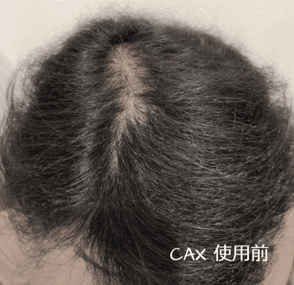 Cax カックス の色はブラック以外ある 髪色ブラウンヘヤーで試してみた 増毛スプレーcaxの口コミブログ