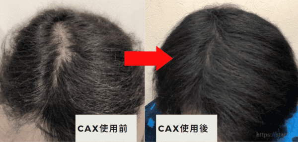 Cax カックス ヘアカバースプレー使い方のコツ 薄毛対策におすすめ 増毛スプレーcaxの口コミブログ